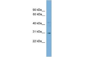 WB Suggested Anti-Gje1 Antibody Titration: 0.