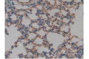 IHC-P analysis of Mouse Lung Tissue, with DAB staining. (Thrombomodulin antibody  (AA 31-167))