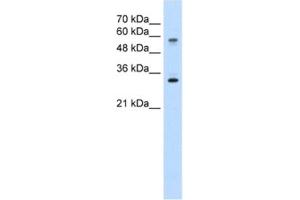 Western Blotting (WB) image for anti-Solute Carrier Family 22 (Organic Cation Transporter), Member 1 (SLC22A1) antibody (ABIN2462442) (SLC22A1 antibody)