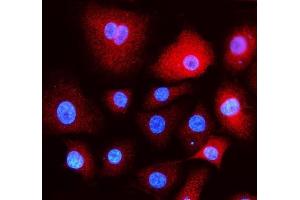 IF analysis of EEA1 using anti- EEA1 antibody (ABIN5692856). (EEA1 antibody)