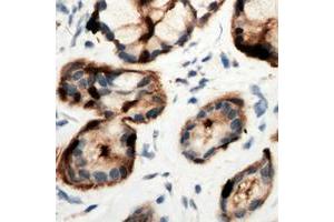 Immunohistochemical analysis of Adenosine A2b Receptor staining in human pancreas formalin fixed paraffin embedded tissue section.