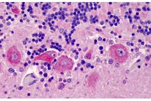 Human  Brain, Cerebellum: Formalin-Fixed, Paraffin-Embedded (FFPE) (GPR77 antibody  (AA 1-50))