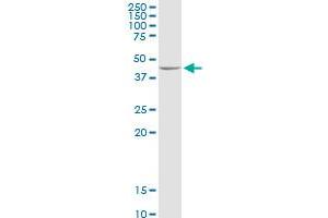 ADHFE1 MaxPab rabbit polyclonal antibody. (ADHFE1 antibody  (AA 1-419))