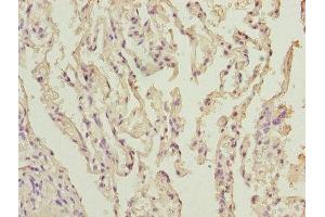 Immunohistochemistry of paraffin-embedded human lung tissue using ABIN7170967 at dilution of 1:100 (UBE2I antibody  (AA 1-157))