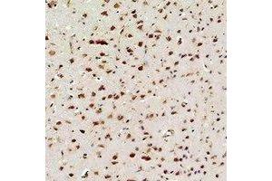 Immunohistochemical analysis of NF-kappaB p65 staining in rat brain  formalin fixed paraffin embedded tissue section. (NF-kB p65 antibody)