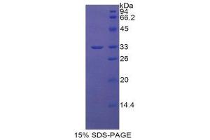 SDS-PAGE (SDS) image for Chitinase 3-Like 1 (Cartilage Glycoprotein-39) (CHI3L1) (AA 112-377) protein (His tag) (ABIN2125051)