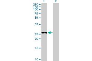 Western Blot analysis of METTL6 expression in transfected 293T cell line by METTL6 MaxPab polyclonal antibody. (METTL6 antibody  (AA 1-255))