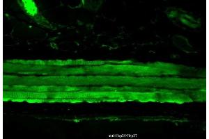 Immunohistochemistry analysis using Mouse Anti-Hsp27 Monoclonal Antibody, Clone 8A7 (ABIN361755 and ABIN361756). (HSP27 antibody)