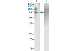 Western Blot analysis of PJA2 expression in transfected 293T cell line by PJA2 monoclonal antibody (M01), clone 1G11. (PJA2 antibody  (AA 302-400))