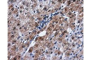 Immunohistochemical staining of paraffin-embedded liver tissue using anti-PPME1mouse monoclonal antibody. (PPME1 antibody)