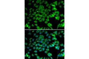 Immunofluorescence analysis of U20S cell using NAA10 antibody. (NAA10 antibody)