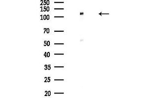 anti-UPF1 Regulator of Nonsense Transcripts Homolog (UPF1) (C-Term) antibody