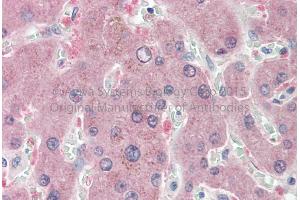 Rabbit Anti-NNMT antibody   Formalin Fixed Paraffin Embedded Tissue: Human Adult Liver  Observed Staining: Cytoplasm in hepatocytes Primary Antibody Concentration: 1:600 Secondary Antibody: Donkey anti-Rabbit-Cy3 Secondary Antibody Concentration: 1:200 Magnification: 20X Exposure Time: 0. (NNMT antibody  (N-Term))