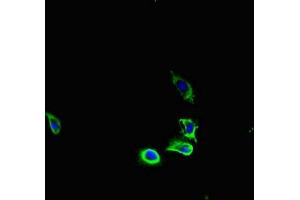 Immunofluorescent analysis of U251 cells using ABIN7163626 at dilution of 1:100 and Alexa Fluor 488-congugated AffiniPure Goat Anti-Rabbit IgG(H+L) (PDGFRA antibody  (AA 30-198))