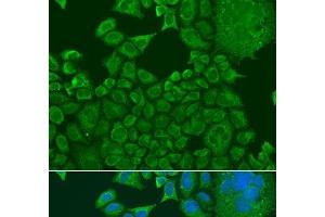 Immunofluorescence analysis of U2OS cells using FXR1 Polyclonal Antibody at dilution of 1:100. (FXR1 antibody)