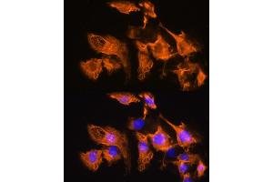 Immunofluorescence analysis of C6 cells using  Rabbit pAb (ABIN7265482) at dilution of 1:100. (ARF4 antibody  (AA 1-180))
