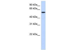 DNTT antibody used at 1 ug/ml to detect target protein. (TdT antibody  (Middle Region))