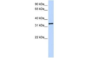 Western Blotting (WB) image for anti-3-hydroxyanthranilate 3,4-Dioxygenase (HAAO) antibody (ABIN2458646)
