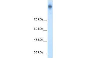WB Suggested Anti-SLC12A2 Antibody Titration: 5. (SLC12A2 antibody  (C-Term))