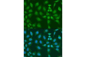 Immunofluorescence analysis of U2OS cells using PHF21B antibody. (PHF21B antibody  (AA 322-531))