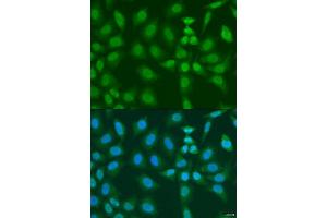 Immunofluorescence analysis of U2OS cells using PHF21B antibody. (PHF21B antibody  (AA 322-531))