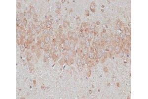 Immunohistochemistry of paraffin-embedded Rat brain using TMX1 Polyclonal Antibody at dilution of 1:100 (40x lens). (TMX1 antibody)