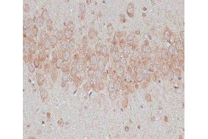 Immunohistochemistry of paraffin-embedded Rat brain using TMX1 Polyclonal Antibody at dilution of 1:100 (40x lens). (TMX1 antibody)