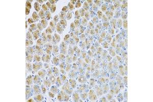 Immunohistochemistry of paraffin-embedded mouse stomach using AP1M2 antibody at dilution of 1:100 (x40 lens). (AP1m2 antibody)