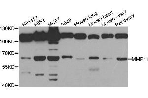 Western blot analysis of extracts of various cell lines, using MMP11 antibody. (MMP11 antibody)