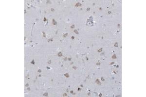 Immunohistochemical staining of human cerebral cortex with CCNJ polyclonal antibody  shows moderate cytoplasmic positivity in neuronal cells. (Cyclin J antibody)