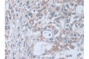Immunohistochemistry (IHC) image for anti-Synaptosomal-Associated Protein, 23kDa (SNAP23) (AA 1-211) antibody (ABIN7444214)