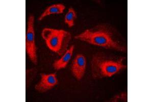 Immunofluorescent analysis of HSPH1 staining in HeLa cells.