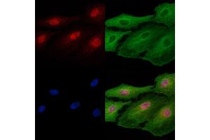 ABIN7094781 and ABIN7098832 staining  cells by IF/ICC. (FOXF2 antibody  (Internal Region))
