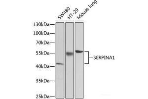 Western blot analysis of extracts of various cell lines using SERPINA1 Polyclonal Antibody at dilution of 1:1000. (SERPINA1 antibody)
