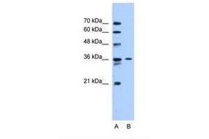 Image no. 1 for anti-Solute Carrier Family 35 (UDP-N-Acetylglucosamine (UDP-GlcNAc) Transporter), Member A3 (SLC35A3) (AA 151-200) antibody (ABIN6738101) (SLC35A3 antibody  (AA 151-200))