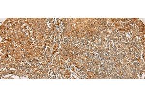 Immunohistochemistry of paraffin-embedded Human tonsil tissue using FLNC Polyclonal Antibody at dilution of 1:30(x200) (FLNC antibody)