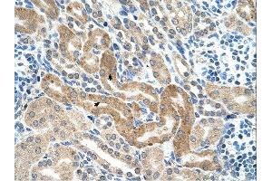 CHAF1B antibody was used for immunohistochemistry at a concentration of 4-8 ug/ml. (CHAF1B antibody)