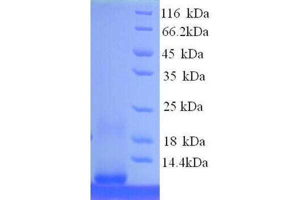 MT1F Protein (AA 1-59, partial) (His tag)