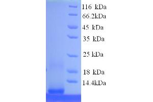 SDS-PAGE (SDS) image for Metallothionein 1F (MT1F) (AA 1-59), (partial) protein (His tag) (ABIN4974712)