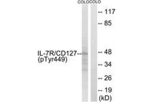 Western blot analysis of extracts from COLO205 cells, using IL-7R/CD127 (Phospho-Tyr449) Antibody. (IL7R antibody  (pTyr449))