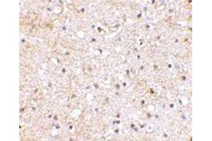 Immunohistochemical staining of human brain tissue using GRIK1 polyclonal antibody  at 2.