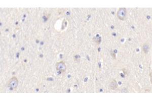 Detection of RETN in Bovine Cerebrum Tissue using Polyclonal Antibody to Resistin (RETN) (Resistin antibody  (AA 19-109))