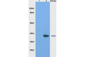 L1 mouse ovary lysates L2 mouse brain lysates probed with Anti StAR/StARD1 Polyclonal Antibody, Unconjugated (ABIN700960) at 1:200 overnight at 4 °C. (STAR antibody  (AA 101-200))