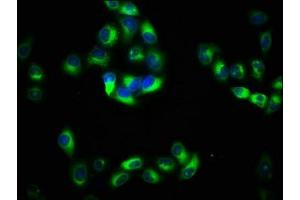 Immunofluorescence (IF) image for anti-Protein Kinase C and Casein Kinase Substrate in Neurons 2 (PACSIN2) (AA 240-410) antibody (ABIN7165686)