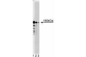 Western blot analysis of ROCK-II on RSV-3T3 lysate. (ROCK2 antibody  (AA 567-718))