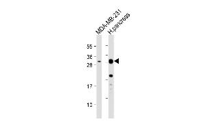 All lanes : Anti-PRSS3 Antibody (Center) at 1:1000 dilution Lane 1: MDA-MB-231 whole cell lysate Lane 2: human pancreas lysate Lysates/proteins at 20 μg per lane. (PRSS3 antibody  (AA 136-163))