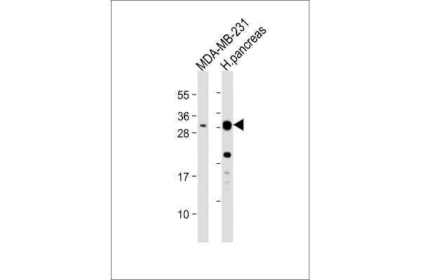 PRSS3 Antikörper  (AA 136-163)
