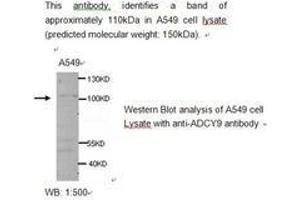 Image no. 1 for anti-Adenylate Cyclase 9 (ADCY9) antibody (ABIN790779) (ADCY9 antibody)