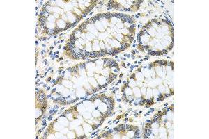 Immunohistochemistry (Paraffin-embedded Sections) (IHC (p)) image for anti-Glucosamine (UDP-N-Acetyl)-2-Epimerase/N-Acetylmannosamine Kinase (GNE) (AA 1-150) antibody (ABIN6141232)