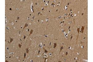 The image on the left is immunohistochemistry of paraffin-embedded Human brain tissue using ABIN7191019(HSPG2 Antibody) at dilution 1/50, on the right is treated with synthetic peptide. (HSPG2 antibody)